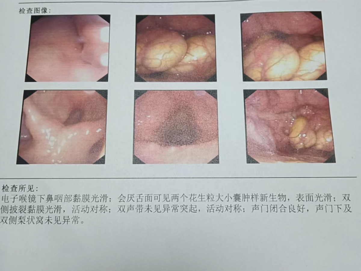 尖锐三个月后未见复发，康复之路与经验分享